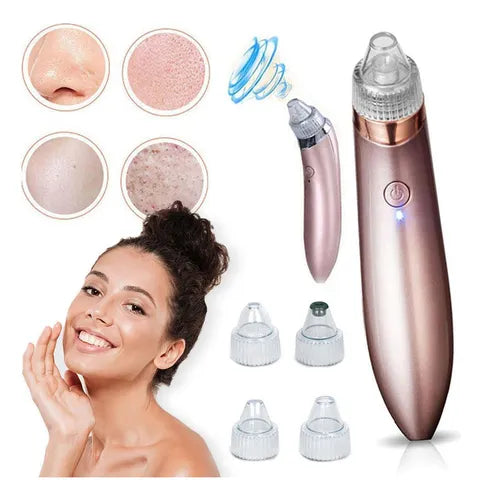 Vakumer za mitisere i bubuljice