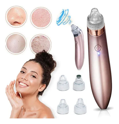 Vakumer za mitisere i bubuljice